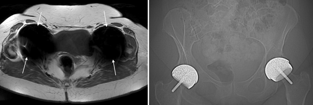 Mri Radiology At St Vincent S University Hospital