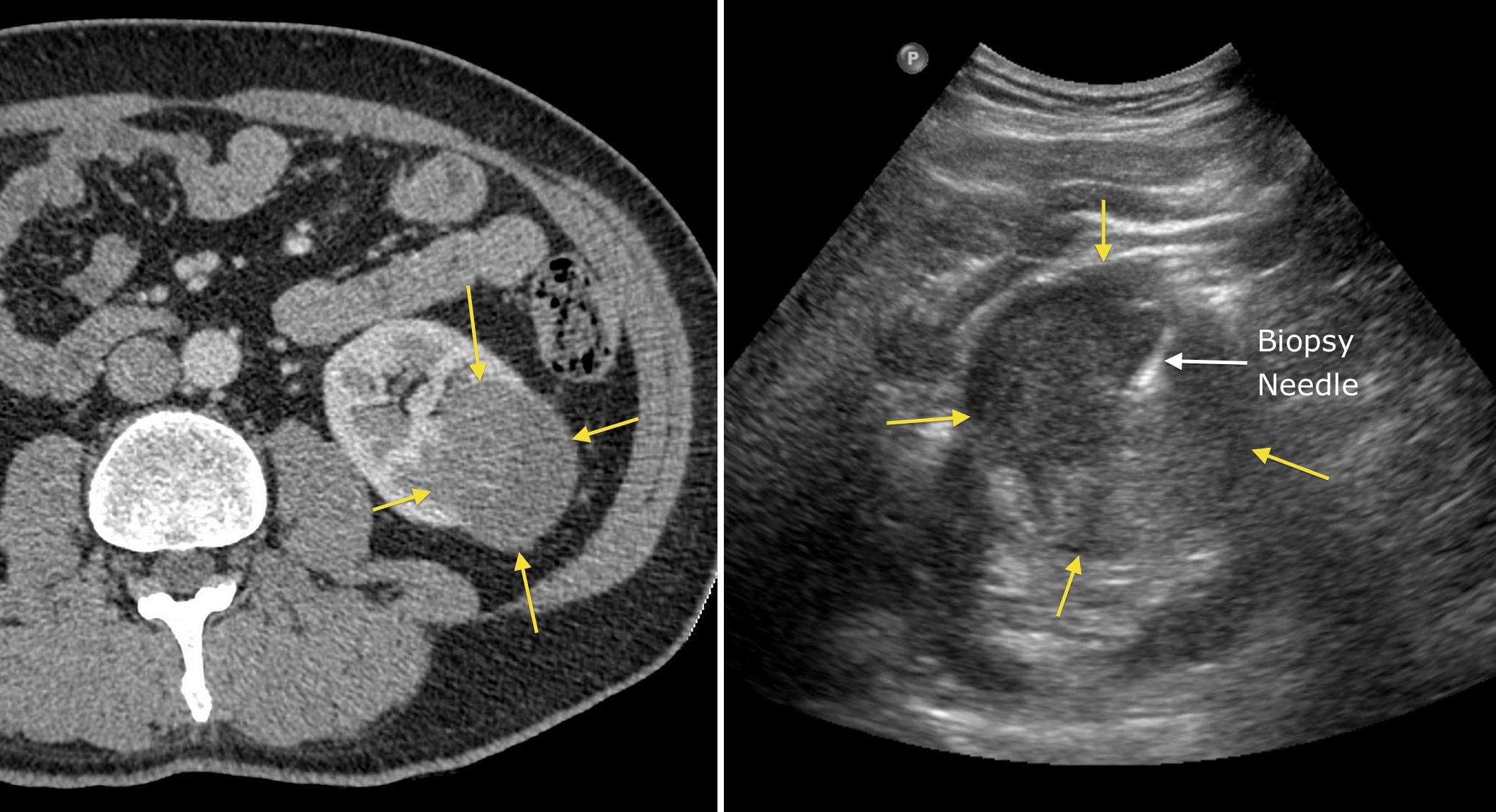 Rccbxcombo Radiology At St Vincents University Hospital