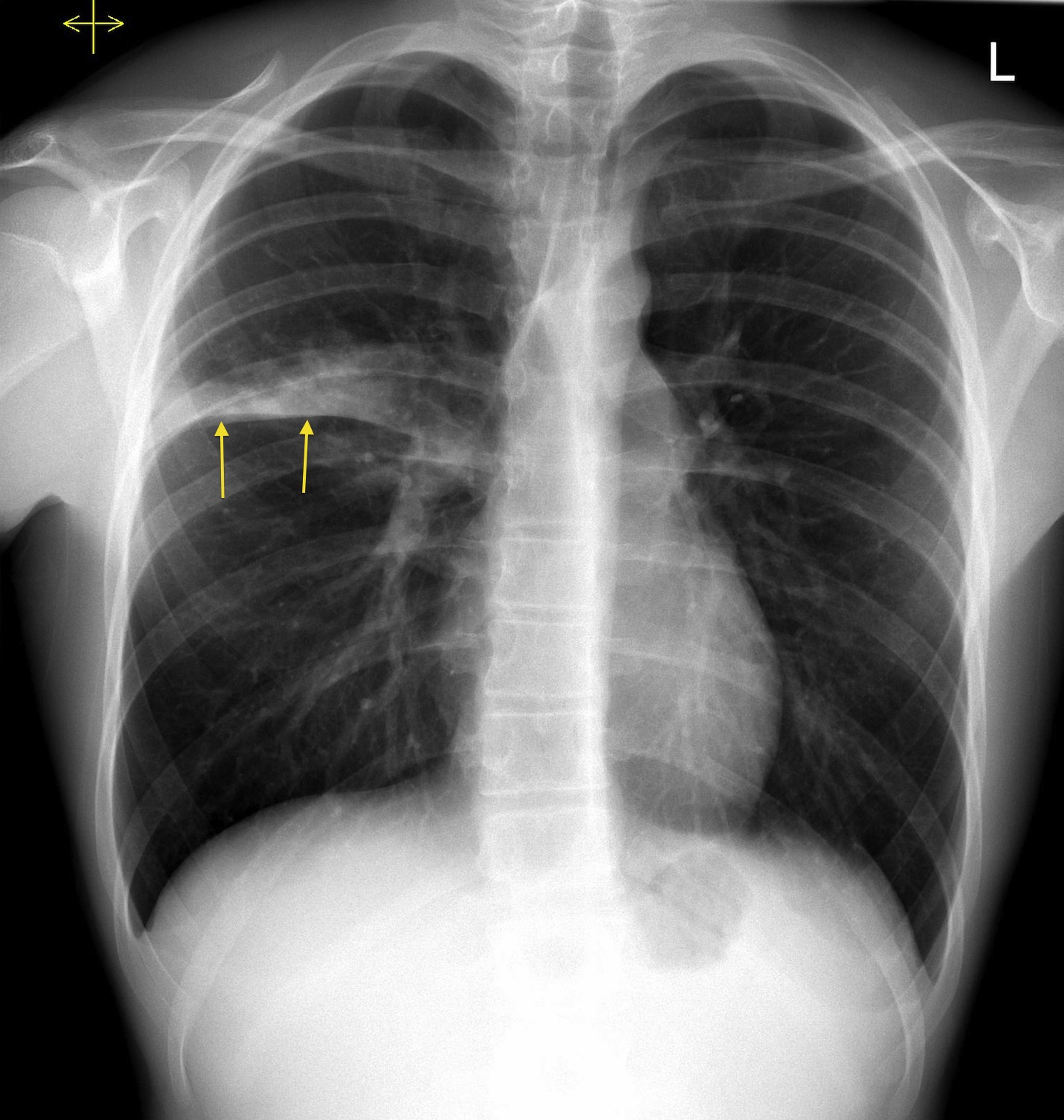 CXR CXR JapaneseClass jp