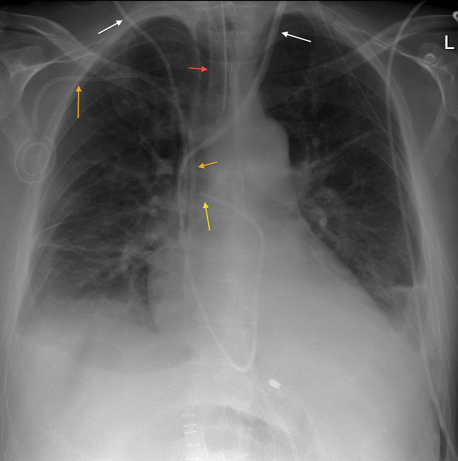 Spaghetti Junction Radiology At St Vincents University Hospital 4913