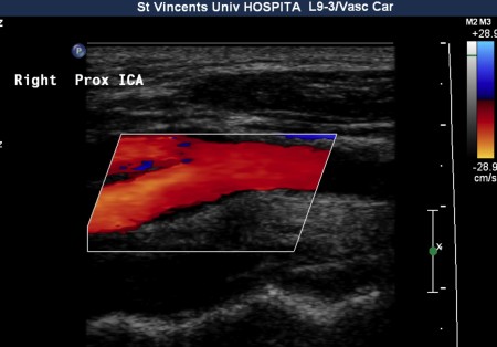 Ultrasound - Radiology At St. Vincent's University Hospital